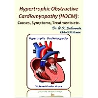 Hypertrophic Obstructive Cardiomyopathy (HOCM): Causes, Symptoms, Treatments etc. Hypertrophic Obstructive Cardiomyopathy (HOCM): Causes, Symptoms, Treatments etc. Kindle