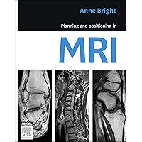 Planning and Positioning in MRI - E-Book Planning and Positioning in MRI - E-Book Kindle Paperback Digital