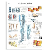 3B Scientific VR1367UU Glossy Paper Varicose Veins Anatomical Chart, Poster Size 20