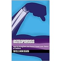 OSTEOPOROSIS: How to strengthen your bones & lower your chance of fracture OSTEOPOROSIS: How to strengthen your bones & lower your chance of fracture Kindle Paperback
