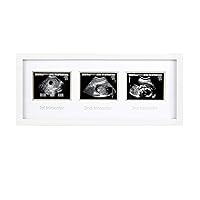 Pearhead Sonogram Progression Frame - Trimester by Trimester Pregnancy Milestone Keepsake, Gender-Neutral Nursery Decor, Displays 1st, 2nd & 3rd Trimester Ultrasound Photos, White