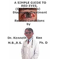 A Simple Guide To Red Eyes (Conjunctivitis), Diagnosis, Treatment And Related Conditions (A Simple Guide to Medical Conditions) A Simple Guide To Red Eyes (Conjunctivitis), Diagnosis, Treatment And Related Conditions (A Simple Guide to Medical Conditions) Kindle