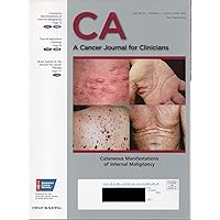 CA: A Cancer Journal for Clinicians, vol. 59, no 2 (March/April 2009) (Cutaneous Manifestations of Internal Malignancy; Thyroid Aspiration Cytology; Novel Agents for Cancer Therapy)