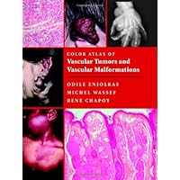 Color Atlas of Vascular Tumors and Vascular Malformations Color Atlas of Vascular Tumors and Vascular Malformations Hardcover