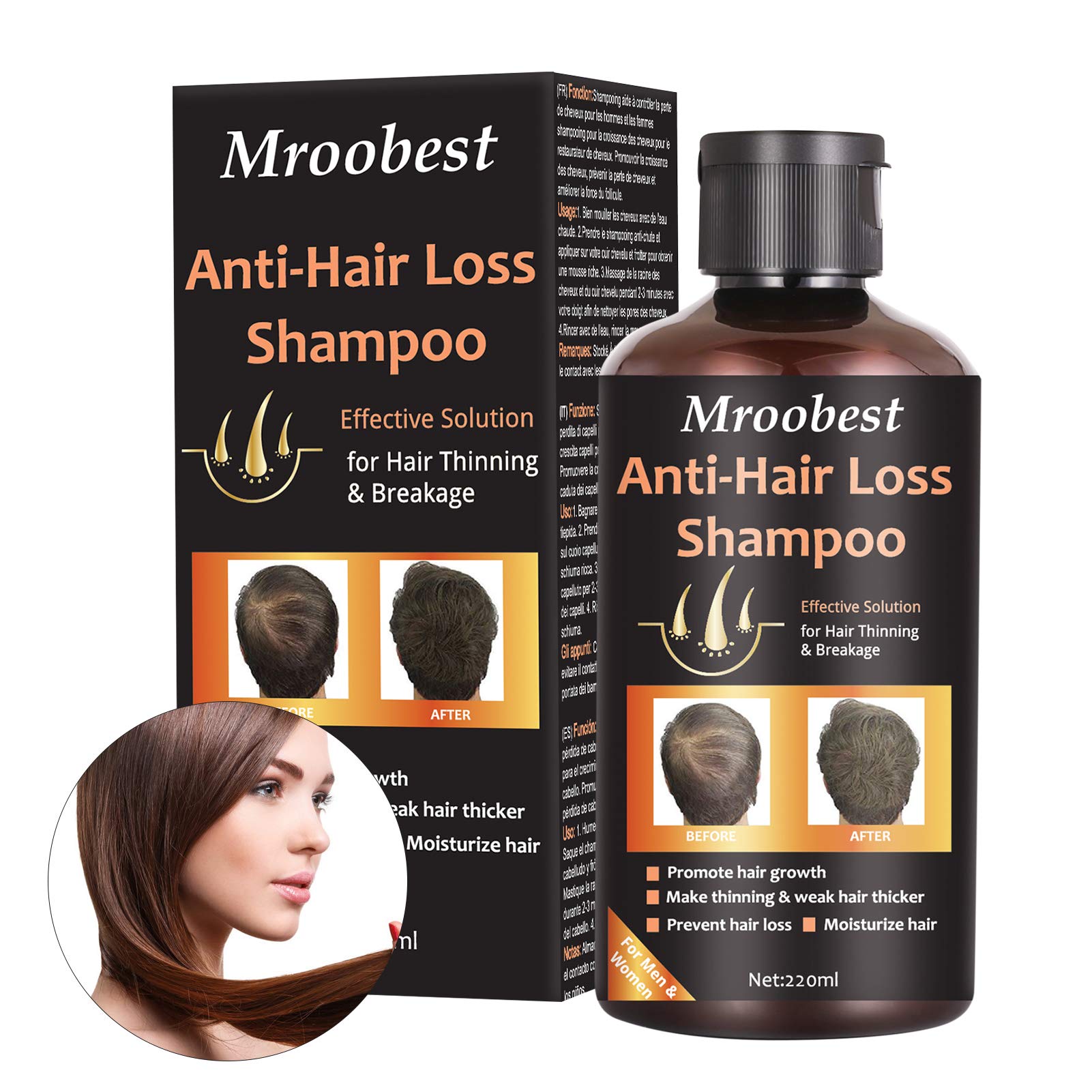 Mua Anti-Hair Loss Shampoo, Hair Growth Shampoo, Effective Solution for Hair  Thinning & Breakage, Helps Stop Hair Loss, Grow Hair Fast, Hair Loss  Treatment for Men & Women(220mL) trên Amazon Anh chính