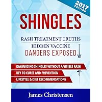 SHINGLES RASH TREATMENT TRUTHS: HIDDEN VACCINE DANGERS EXPOSED