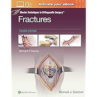 Master Techniques in Orthopaedic Surgery: Fractures Master Techniques in Orthopaedic Surgery: Fractures Hardcover Kindle