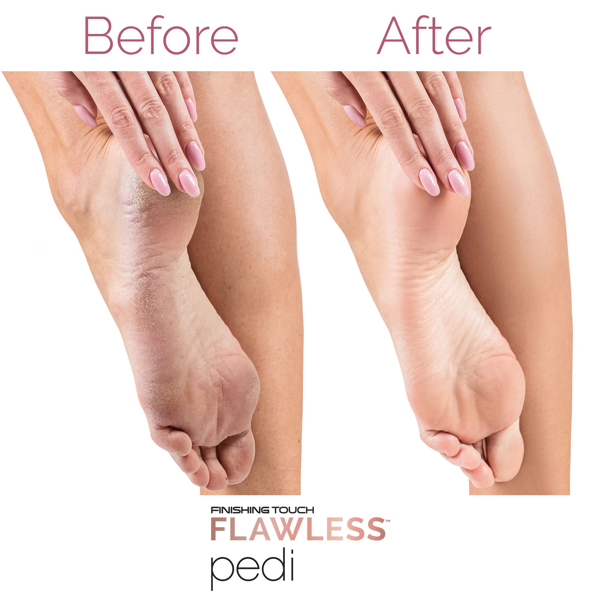 Finishing Touch Flawless Pedi Electronic Tool File and Callus Remover, Pedicure-New Version (Amazon Exclusive)