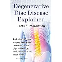 Degenerative Disc Disease Explained: Including treatment, surgery, symptoms, exercises, causes, physical therapy, neck, back pain, and much more! Facts & Information Degenerative Disc Disease Explained: Including treatment, surgery, symptoms, exercises, causes, physical therapy, neck, back pain, and much more! Facts & Information Kindle