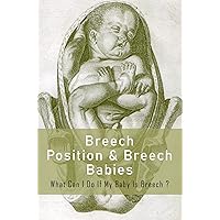 Breech Position & Breech Babies: What Can I Do If My Baby Is Breech? Breech Position & Breech Babies: What Can I Do If My Baby Is Breech? Kindle Paperback