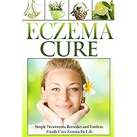 Eczema Cure: Simple Treatments, Remedies and Foods to Finally Cure Eczema for Life (Eczema Treatments, Cure Eczema Fast, Eczema Remedies, Naturally Cure Eczema, Foods for Eczema, Eczema Relief) Eczema Cure: Simple Treatments, Remedies and Foods to Finally Cure Eczema for Life (Eczema Treatments, Cure Eczema Fast, Eczema Remedies, Naturally Cure Eczema, Foods for Eczema, Eczema Relief) Kindle