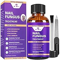 Toenail Fungus Treatment - Extra Strength Nail Fungus Treatment for Toenails and Fingernails - Nail Repair for Damaged Discolored Thick Nails - Fungal Nail Renewal 1oz