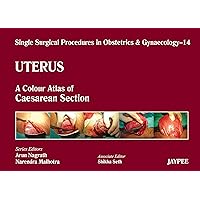 Single Surgical Procedures in Obstetrics and Gynaecology14: A Colour Atlas of Caesarean Section: A.C.A. of Caesarean Section (Single Surgical Procedures In Obs & Gyne) Single Surgical Procedures in Obstetrics and Gynaecology14: A Colour Atlas of Caesarean Section: A.C.A. of Caesarean Section (Single Surgical Procedures In Obs & Gyne) Kindle Hardcover