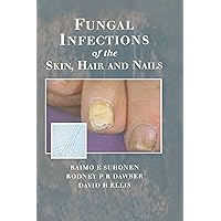 Fungal Infections of the Skin and Nails Fungal Infections of the Skin and Nails Kindle Hardcover Paperback