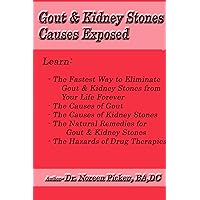 Gout & Kidney Stones Causes Exposed