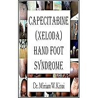 Capecitabine (Xeloda) Hand Foot Syndrome (Skin Diseases Book 14) Capecitabine (Xeloda) Hand Foot Syndrome (Skin Diseases Book 14) Kindle