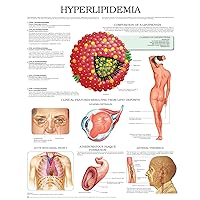 Hyperlipidemia e chart: Full illustrated