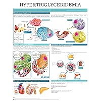 Hypertriglyceridemia e chart: Full illustrated
