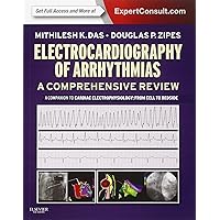Electrocardiography of Arrhythmias: A Comprehensive Review: A Companion to Cardiac Electrophysiology Electrocardiography of Arrhythmias: A Comprehensive Review: A Companion to Cardiac Electrophysiology Paperback