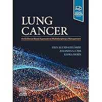 Lung Cancer E-Book: An Evidence-Based Approach to Multidisciplinary Management Lung Cancer E-Book: An Evidence-Based Approach to Multidisciplinary Management Kindle Hardcover
