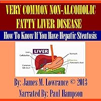 Very Common Non-Alcoholic Fatty Liver Disease Very Common Non-Alcoholic Fatty Liver Disease Audible Audiobook Kindle Paperback