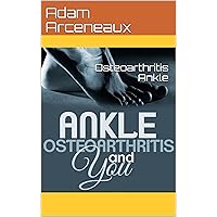 Osteoarthritis Ankle