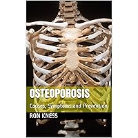 Osteoporosis : Causes, Symptoms and Prevention Osteoporosis : Causes, Symptoms and Prevention Kindle Paperback
