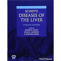 Schiff's Diseases of the Liver Schiff's Diseases of the Liver Hardcover Kindle
