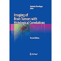Imaging of Brain Tumors with Histological Correlations Imaging of Brain Tumors with Histological Correlations Kindle Hardcover Paperback