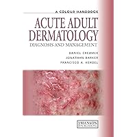 Acute Adult Dermatology: Diagnosis and Management: A Colour Handbook (Medical Color Handbook Series) Acute Adult Dermatology: Diagnosis and Management: A Colour Handbook (Medical Color Handbook Series) Kindle Paperback