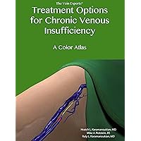 Treatment Options for Chronic Venous Insufficiency