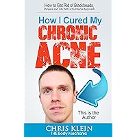 How I Cured My Chronic Acne: How to Get Rid of Blackheads, Pimples and Zits With a Nutritional Approach: The truth about acne, acne remedy, acne free, clear skin acne, the acne diet, plus free books!