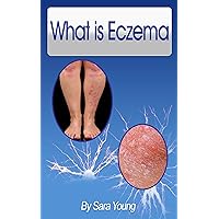 What is Eczema