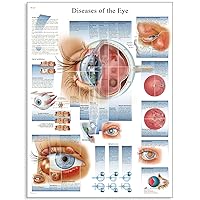 3B Scientific VR1231UU Glossy Paper Diseases of The Eye Anatomical Chart, Poster Size 20