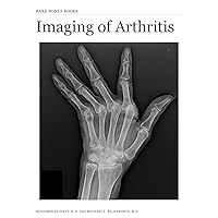 Imaging of Arthritis