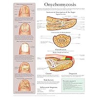 Onychomycosis e chart: Full illustrated