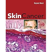 Skin Cancer Skin Cancer Kindle Hardcover