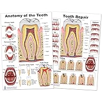 Anatomy of The Teeth, Tooth Implant and Repair Poster LP 24x36 inch, 2 Poster Set
