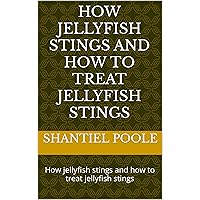 How jellyfish stings and how to treat jellyfish stings: How jellyfish stings and how to treat jellyfish stings