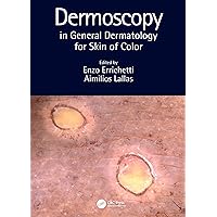 Dermoscopy in General Dermatology for Skin of Color Dermoscopy in General Dermatology for Skin of Color Hardcover Kindle