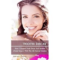 Tooth Decay: How I Stopped Tooth Decay And Avoided Dental Surgery With This All Natural Solution