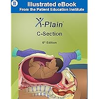 X-Plain ® C-Section X-Plain ® C-Section Kindle