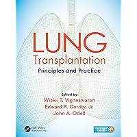 Lung Transplantation: Principles and Practice Lung Transplantation: Principles and Practice Kindle Paperback Hardcover