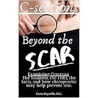 C-sections: Beyond the Scar: Examining Cesarean C-sections: Beyond the Scar: Examining Cesarean Kindle Paperback