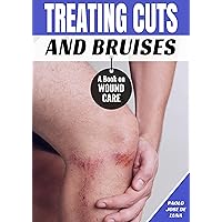Treating Cuts and Bruises: A Book on Wound Care Treating Cuts and Bruises: A Book on Wound Care Kindle Paperback