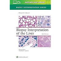 Biopsy Interpretation of the Liver (Biopsy Interpretation Series) Biopsy Interpretation of the Liver (Biopsy Interpretation Series) Hardcover Kindle