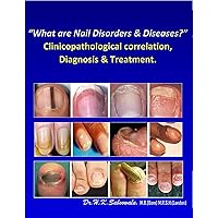“What are Nail Disorders & Diseases?” Clinicopathological correlation, Diagnosis & Treatment. “What are Nail Disorders & Diseases?” Clinicopathological correlation, Diagnosis & Treatment. Kindle