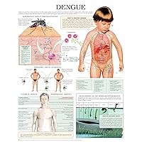 Dengue e chart: Full illustrated