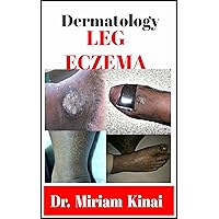 Dermatology: Leg Eczema