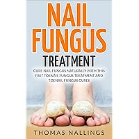 Nail Fungus Treatment: Cure Nail Fungus Naturally With This Fast Toenail Fungus Treatment and Toenail Fungus Cures (nail fungus cures, nail fungus treatment, nail fungus) Nail Fungus Treatment: Cure Nail Fungus Naturally With This Fast Toenail Fungus Treatment and Toenail Fungus Cures (nail fungus cures, nail fungus treatment, nail fungus) Kindle Paperback